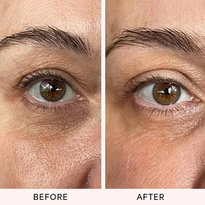 Rachel S., 55 — Denver, CO