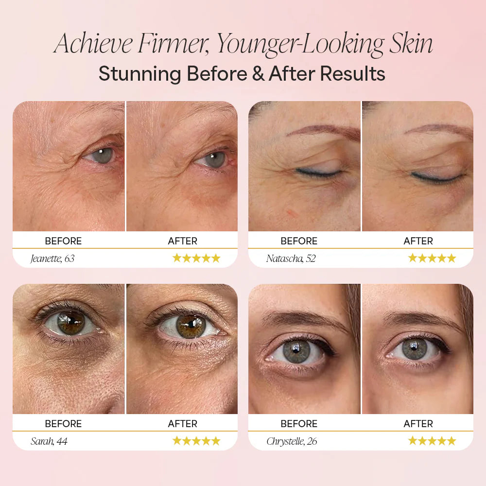 3-in-1 Electric Red Therapy Firming Eye Cream