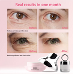 3-in-1 Electric Red Therapy Firming Eye Cream